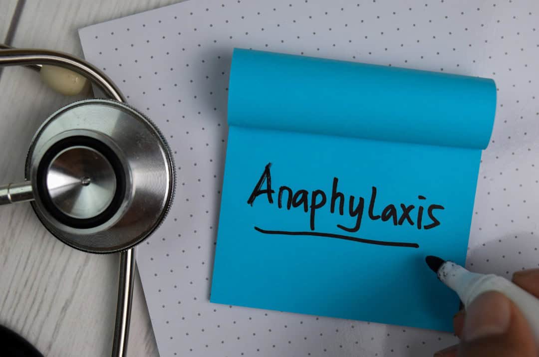 A blue post it note with the writing "Anaphylaxis” on it. This post it note is placed on top of a notepad with s stethoscope to the left hand side of it.